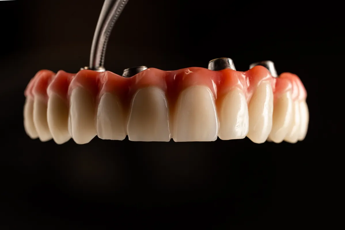 Lucrări Mobilizabile - dentalbit dental bit tg mureș laborator tehnică dentară laborator tehnica dentara tg mures mures fogtechnikus marosvasarhely fogtechnia CAD/CAM exocad digital Laborator Tehnică Dentară Proiectare Digitală Dentară Lucrări Fixe Lucrări Fixe Pe Implant Lucrări Mobile Lucrări Mobilizabile tehnică dentară digitală