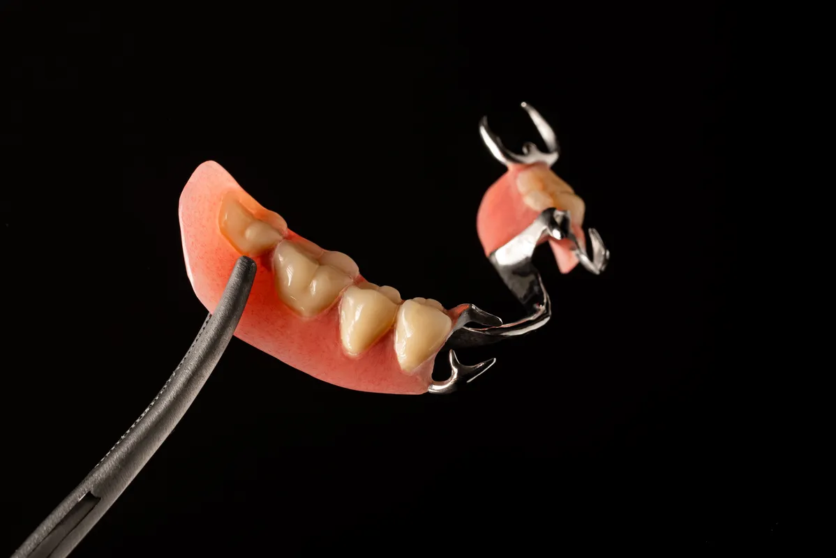 Lucrări Mobilizabile - dentalbit dental bit tg mureș laborator tehnică dentară laborator tehnica dentara tg mures mures fogtechnikus marosvasarhely fogtechnia CAD/CAM exocad digital Laborator Tehnică Dentară Proiectare Digitală Dentară Lucrări Fixe Lucrări Fixe Pe Implant Lucrări Mobile Lucrări Mobilizabile tehnică dentară digitală