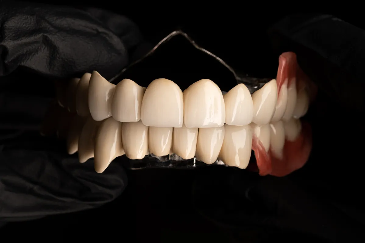 Lucrări Mobilizabile - dentalbit dental bit tg mureș laborator tehnică dentară laborator tehnica dentara tg mures mures fogtechnikus marosvasarhely fogtechnia CAD/CAM exocad digital Laborator Tehnică Dentară Proiectare Digitală Dentară Lucrări Fixe Lucrări Fixe Pe Implant Lucrări Mobile Lucrări Mobilizabile tehnică dentară digitală