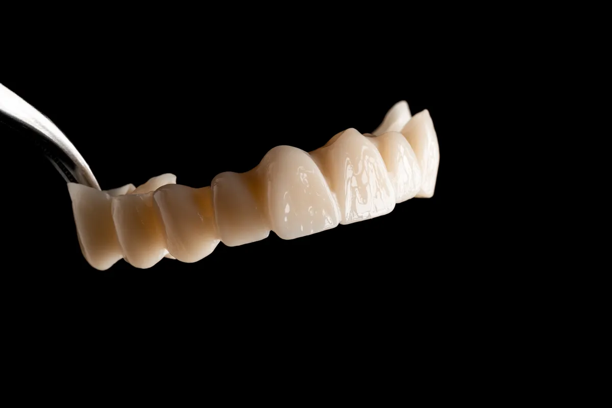 Lucrări Fixe - dentalbit dental bit tg mureș laborator tehnică dentară laborator tehnica dentara tg mures mures fogtechnikus marosvasarhely fogtechnia CAD/CAM exocad digital Laborator Tehnică Dentară Proiectare Digitală Dentară Lucrări Fixe Lucrări Fixe Pe Implant Lucrări Mobile Lucrări Mobilizabile tehnică dentară digitală