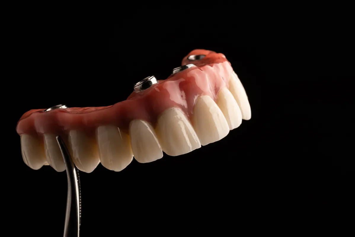 Lucrări Mobilizabile - dentalbit dental bit tg mureș laborator tehnică dentară laborator tehnica dentara tg mures mures fogtechnikus marosvasarhely fogtechnia CAD/CAM exocad digital Laborator Tehnică Dentară Proiectare Digitală Dentară Lucrări Fixe Lucrări Fixe Pe Implant Lucrări Mobile Lucrări Mobilizabile tehnică dentară digitală