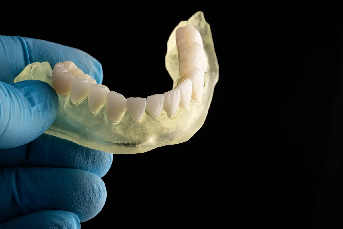 Lucrări Fixe - dentalbit dental bit tg mureș laborator tehnică dentară laborator tehnica dentara tg mures mures fogtechnikus marosvasarhely fogtechnia CAD/CAM exocad digital Laborator Tehnică Dentară Proiectare Digitală Dentară Lucrări Fixe Lucrări Fixe Pe Implant Lucrări Mobile Lucrări Mobilizabile tehnică dentară digitală