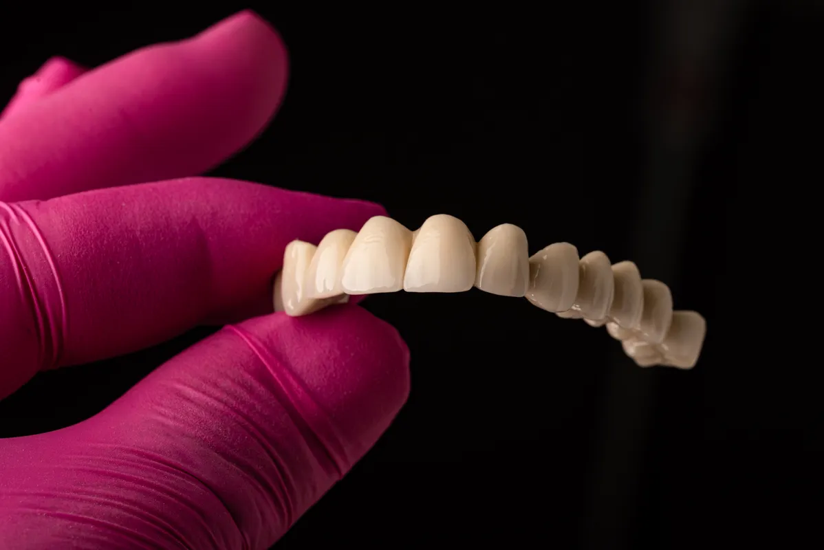 Lucrări Fixe - dentalbit dental bit tg mureș laborator tehnică dentară laborator tehnica dentara tg mures mures fogtechnikus marosvasarhely fogtechnia CAD/CAM exocad digital Laborator Tehnică Dentară Proiectare Digitală Dentară Lucrări Fixe Lucrări Fixe Pe Implant Lucrări Mobile Lucrări Mobilizabile tehnică dentară digitală